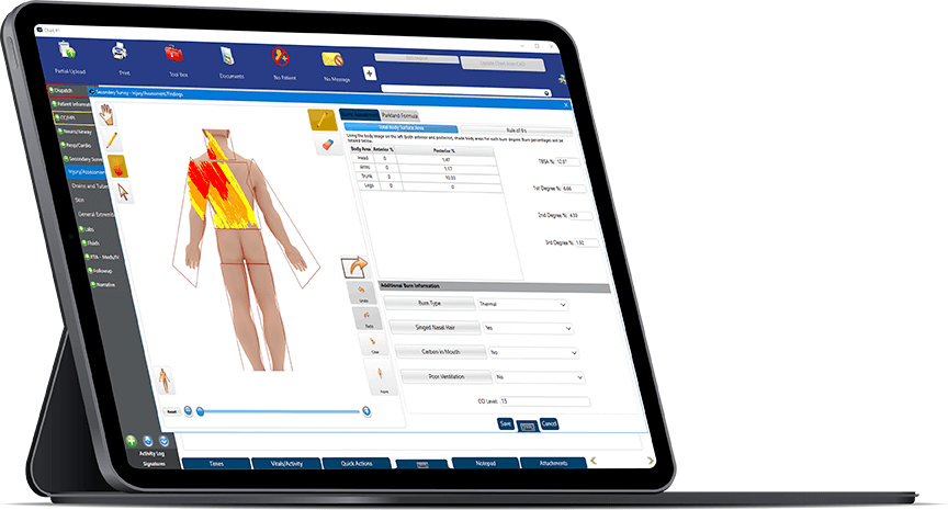 EMS Electronic Patient Records | ZOLL® emsCharts® | ZOLL Data Systems